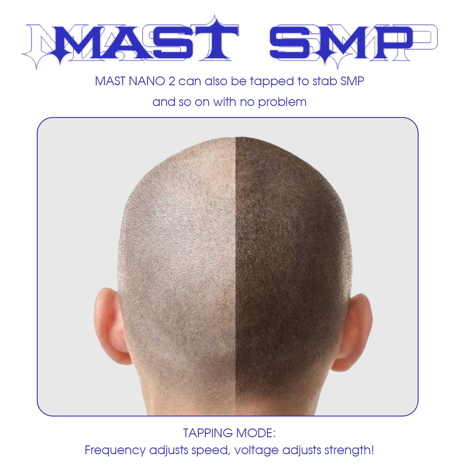 Mast Nano 2 (rose gold)