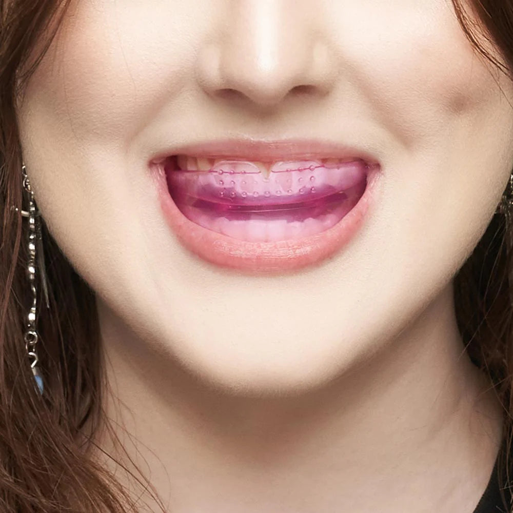 Ultimate Beauty Lip Assist mouthguard for lip blushing— Pink